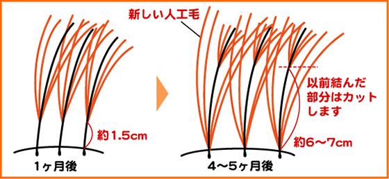 �A�t�^�[�T�|�[�g